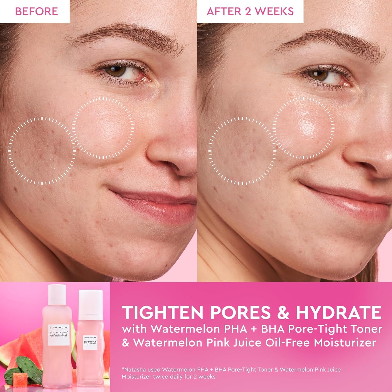 Pink Juice Hydrating Face Moisturizer for Women & Men - Korean Skin Care Moisturizer with Hyaluronic Acid for Glass Skin - Lightweight Gel Moisturizer for Dry Skin (50Ml)
